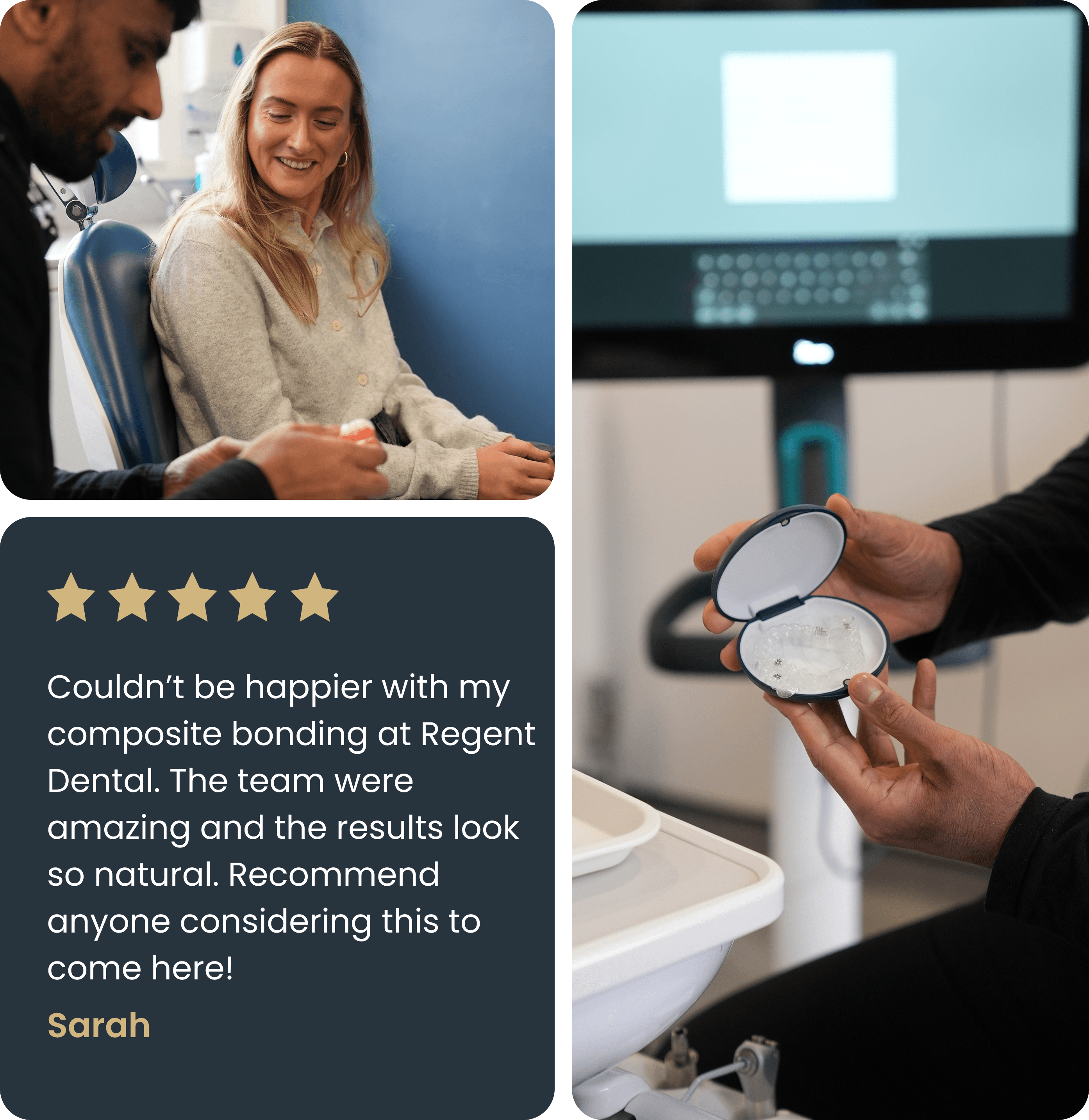 Composite bonding smile transformation