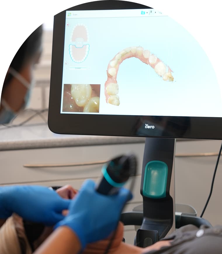Digital dental scan used during implant treatment planning