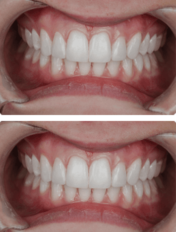Patient Result