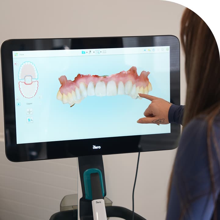Intraoral Scanner at Regent Dental Care