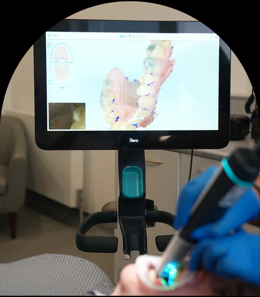 Digital scan used for restorative dental treatment planning