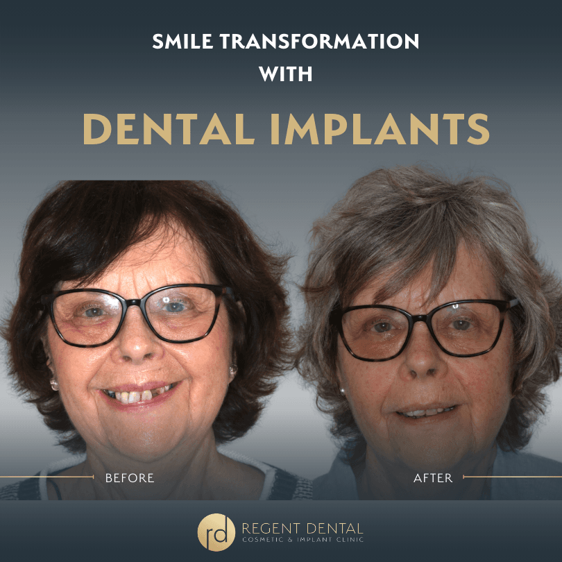 smile transformation at Regent Dental Care