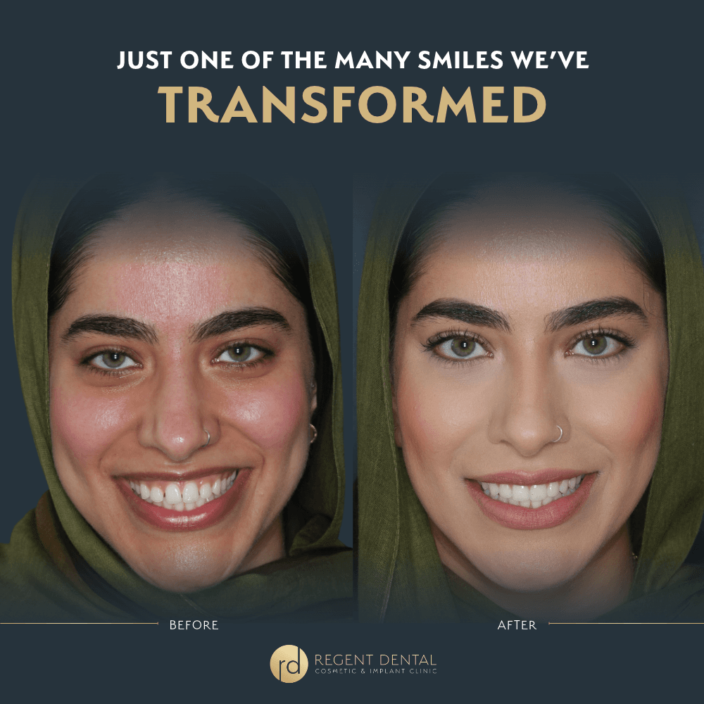 smile transformation at Regent Dental Care