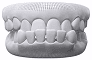 Underbite