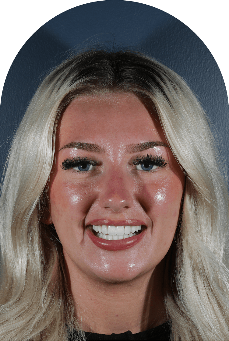 Patient smiling after completing her smile treatment