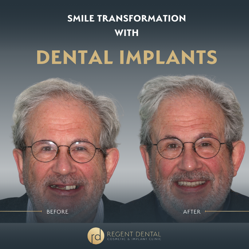 smile transformation at Regent Dental Care
