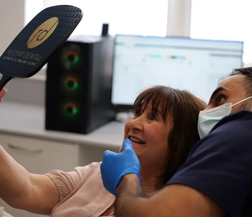 composite bonding before and after